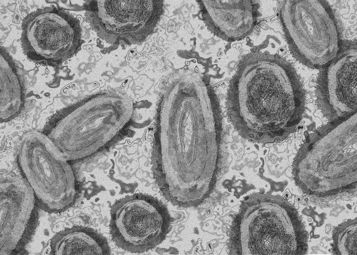 猴痘显微图像
