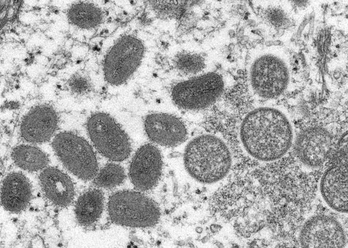 猴痘病毒的显微图像
